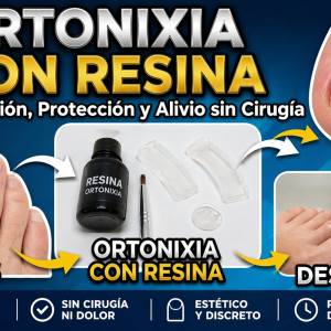 Ortonixia con resina